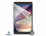 Screenshield IGET Smart G102 folie na displej