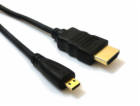 LogiLink HDMI Micro - HDMI kabel 2m černý (CH0032)