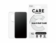PG CARE Xiaomi Redmi Note 15 Pro+ X-Ray